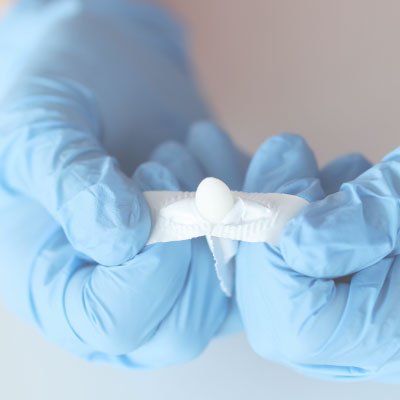 Hämorrhoiden Behandlung