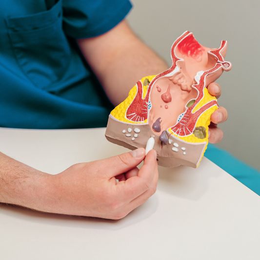 Analfissur Behandlung Zaepfchen